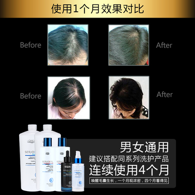 科技賦能防脫，歐萊雅芯基源洗護套裝 深入發芯，重塑強韌發絲